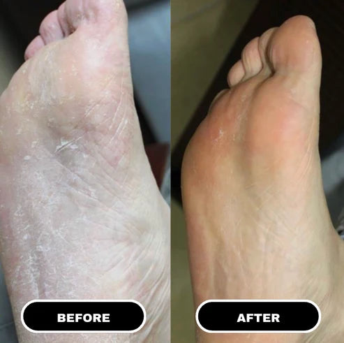 HeelWell Pain Relief Stick