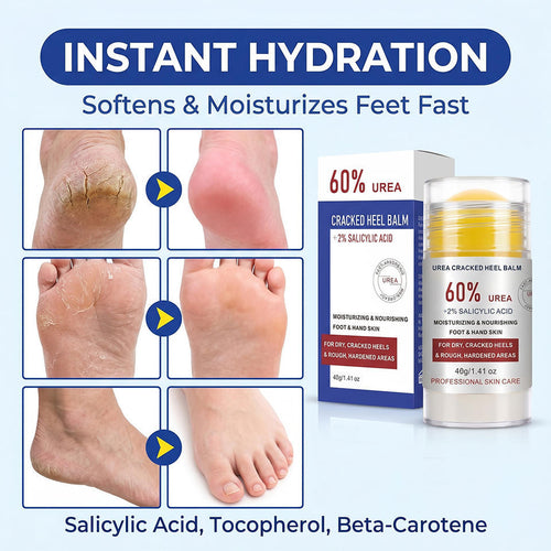 HeelWell Pain Relief Stick